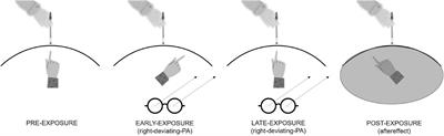 Right-deviating prismatic adaptation reduces obsessions in a community sample